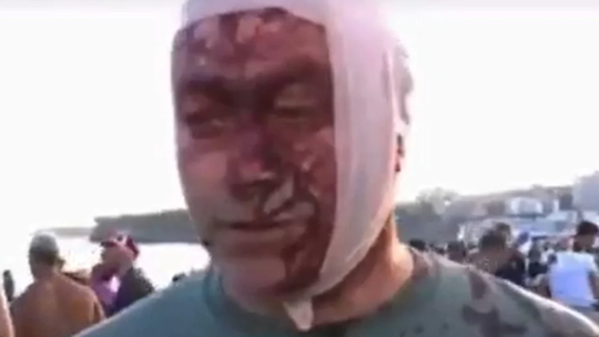 Ostrovsky relató: Estaba aquí con mi familia, era la celebración de Janucá. Había cientos de personas, niños, familias mayores disfrutando del festival, y de repente, todo fue un caos. No sabíamos qué estaba pasando, de dónde venía el fuego. Vi sangre brotando frente a mí, a personas ser alcanzadas y caer al suelo. Mi única preocupación era dónde estaba mi familia. Ostrovsky relató: Estaba aquí con mi familia, era la celebración de Janucá. Había cientos de personas, niños, familias mayores disfrutando del festival, y de repente, todo fue un caos. No sabíamos qué estaba pasando, de dónde venía el fuego. Vi sangre brotando frente a mí, a personas ser alcanzadas y caer al suelo. Mi única preocupación era dónde estaba mi familia.