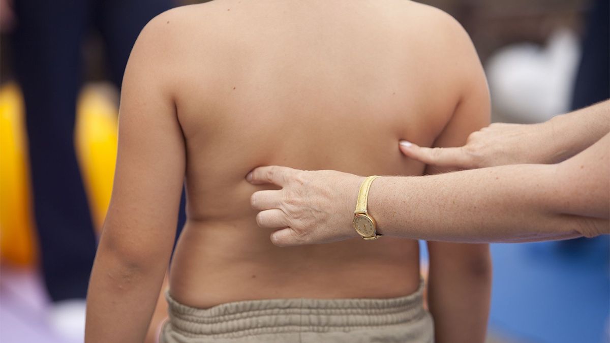 Los casos de niños con obesidad aumentaron aunque los especialistas aseguraron que no están condenados a ser adultos obesos pero el riesgo es real. Los casos de niños con obesidad aumentaron aunque los especialistas aseguraron que no están condenados a ser adultos obesos pero el riesgo es real.