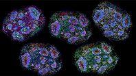 Ungrupo de científicos realizó un experimento en el que llevan en estado demaduración unos minicerebros humanos cultivados en laboratorio. Ungrupo de científicos realizó un experimento en el que llevan en estado demaduración unos minicerebros humanos cultivados en laboratorio.