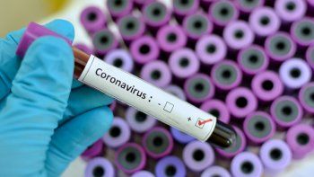 Hacen un llamado para reforzar las medidas contra el COVID. Hacen un llamado para reforzar las medidas contra el COVID.