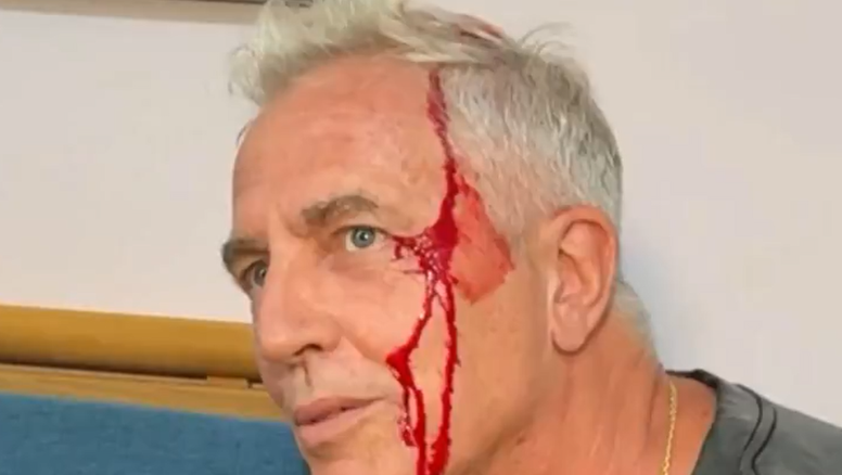 Marley se accidentó en Tailandia tras asisitir a Karina Jelinek