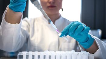 Desde la Red de Autoridades de Ciencia y Tecnología advirtieron que, como en la crisis del 2001, comenzó la fuga de cerebros. Desde la Red de Autoridades de Ciencia y Tecnología advirtieron que, como en la crisis del 2001, comenzó la fuga de cerebros.