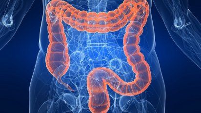 Intestino inflamado: Advierten por este alimento cotidiano