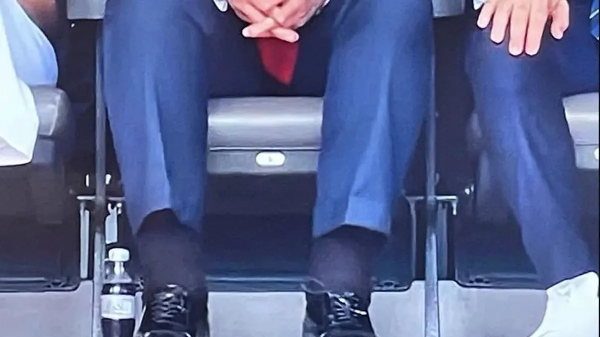 Trump padece insuficiencia venosa crónica, algo muy común en la cuarta edad Trump padece insuficiencia venosa crónica, algo muy común en la cuarta edad