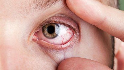 Este síntoma en tus ojos puede advertir falta de magnesio