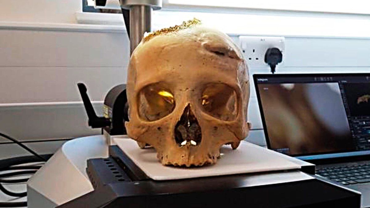 Ciencia: Encontraron cráneos de 4.000 años en los que se habrían buscado la  cura al cáncer