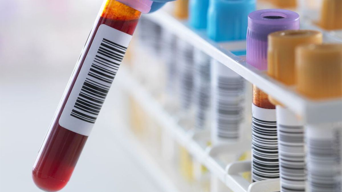 La enfermedad de Alzheimer afecta al 70% de las personas que son diagnosticadas de demencia en el mundo. La enfermedad de Alzheimer afecta al 70% de las personas que son diagnosticadas de demencia en el mundo.