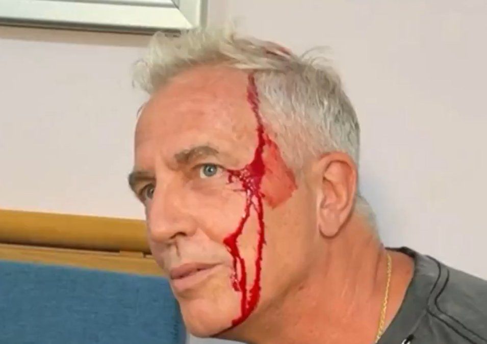 Marley se accidentó fuertemente en Tailandia tras asisitir a Karina Jelinek.