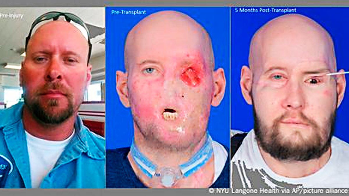 La ciencia no deja de maravillar.