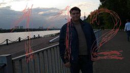 altText(Rusia: Un muchacho murió en una rinoplastia y su madre culpa al anestesista)}