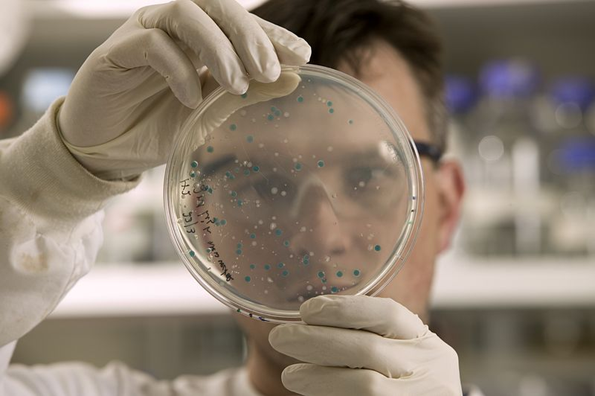 Las proteínas podrían ser un punto esencial. Las proteínas podrían ser un punto esencial.