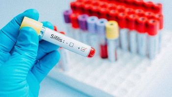 Síntomas de la sífilis y cómo avanza en Argentina. Síntomas de la sífilis y cómo avanza en Argentina.