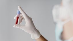 Cáncer relacionado con el VPH y sexo oral: Avance en la detección temprana / Imagen de Freepik.