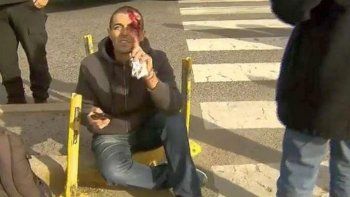 atropellaron a federico delgado: el fiscal del caso odebrecht atropellaron a federico delgado: el fiscal del caso odebrecht