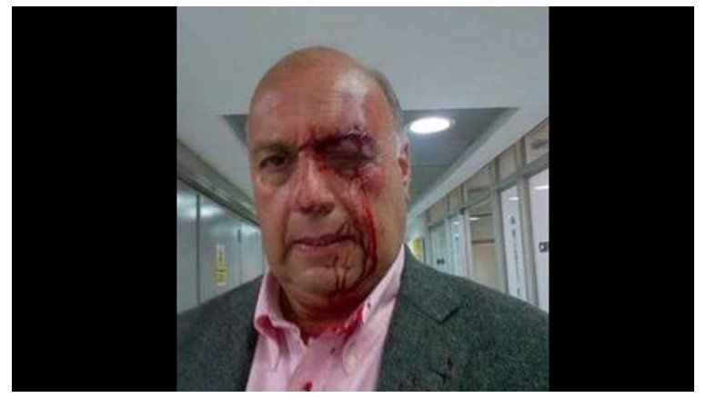 Intoxicada Cristina, legitima la violencia de Maduro