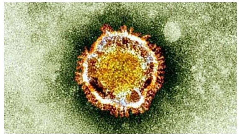 Advierte la OMS que el 'coronavirus' puede transmitirse entre humanos