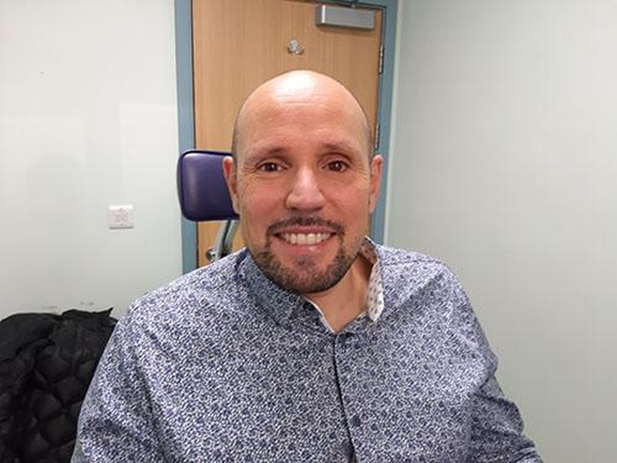 Steve Verze, el paciente brit&aacute;nico que recibi&oacute; la pr&oacute;tesis de ojo.