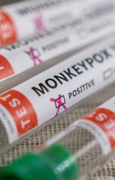 Ciencia en la mira: Explota escándalo con virus de viruela del mono en Estados Unidos
