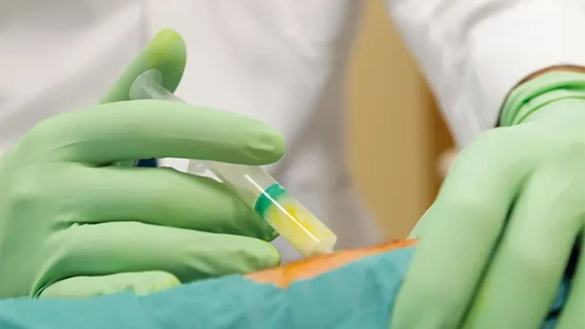 Los tratamientos con células madre sumado a la cirugía y la aplicación intraoperatoria apuntan a tratar las lesiones de rodilla. Los tratamientos con células madre sumado a la cirugía y la aplicación intraoperatoria apuntan a tratar las lesiones de rodilla.