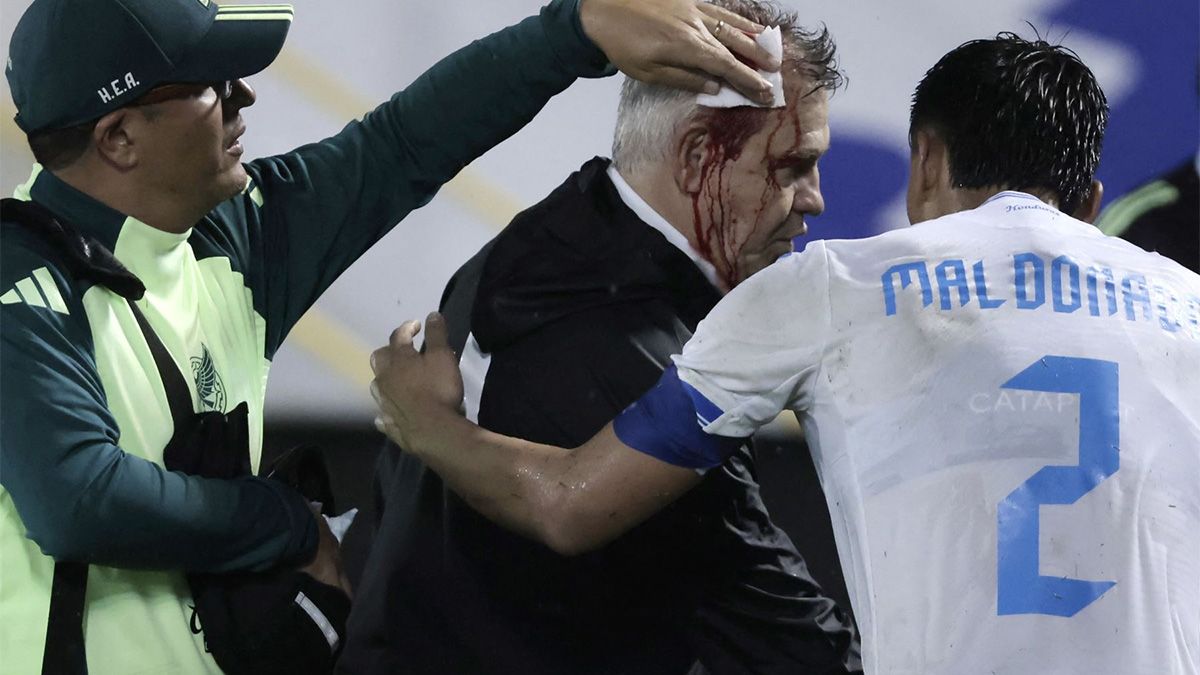 Honduras fue castigada por la Concacaf con la disputa de un partido sin público tras la agresión que sufrió el entrenador de México, Javier Aguirre. Honduras fue castigada por la Concacaf con la disputa de un partido sin público tras la agresión que sufrió el entrenador de México, Javier Aguirre.