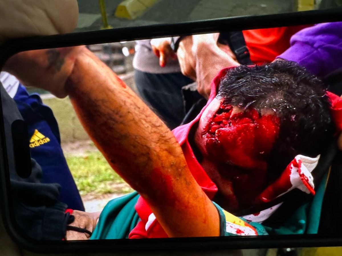 El foto periodista fue alcanzado por el tubo de gas lacrimógeno El foto periodista fue alcanzado por el tubo de gas lacrimógeno