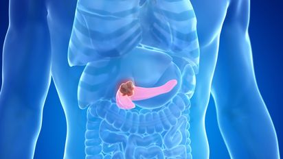 Tenía dolor de espalda y piernas, fue 24 veces al doctor hasta que le detectaron cáncer: Murió a los 12 días