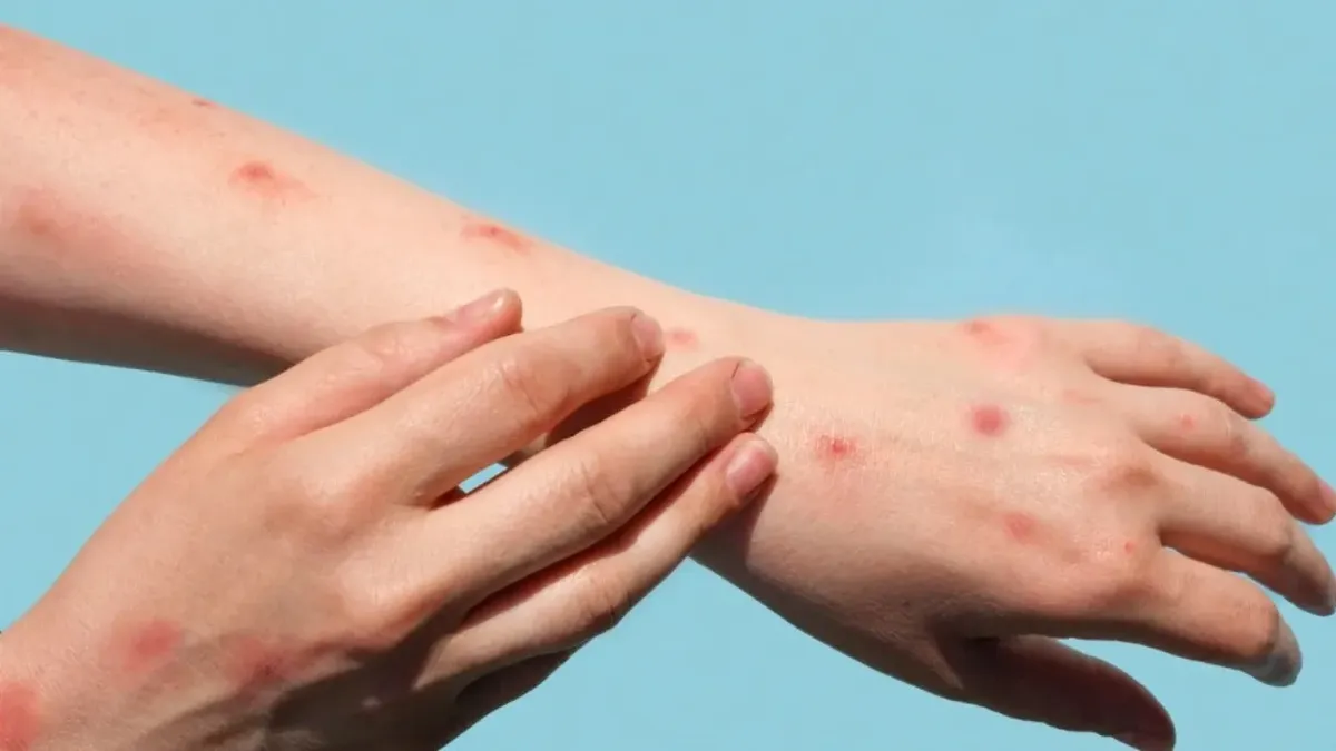 La "emergencia de interés internacional" es el nivel más alto de alerta.