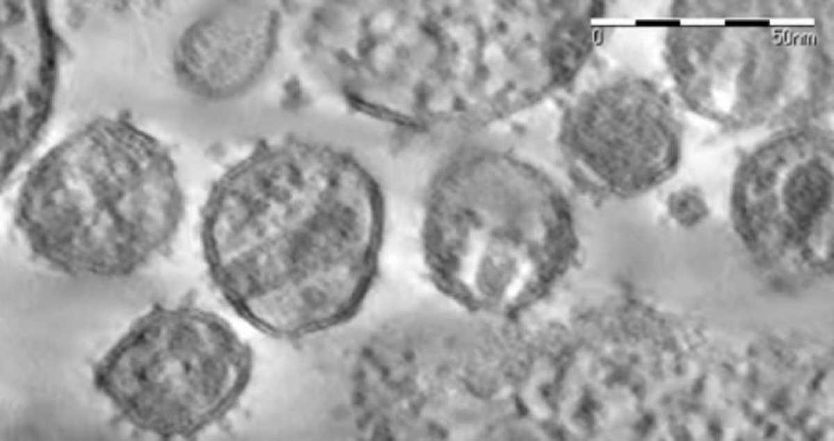 Poco despu&eacute;s de que se encontrara la enzima responsable de la replicaci&oacute;n del VIH, el equipo del Instituto Pasteur pudo observar al virus por primera vez en el microscopio.
