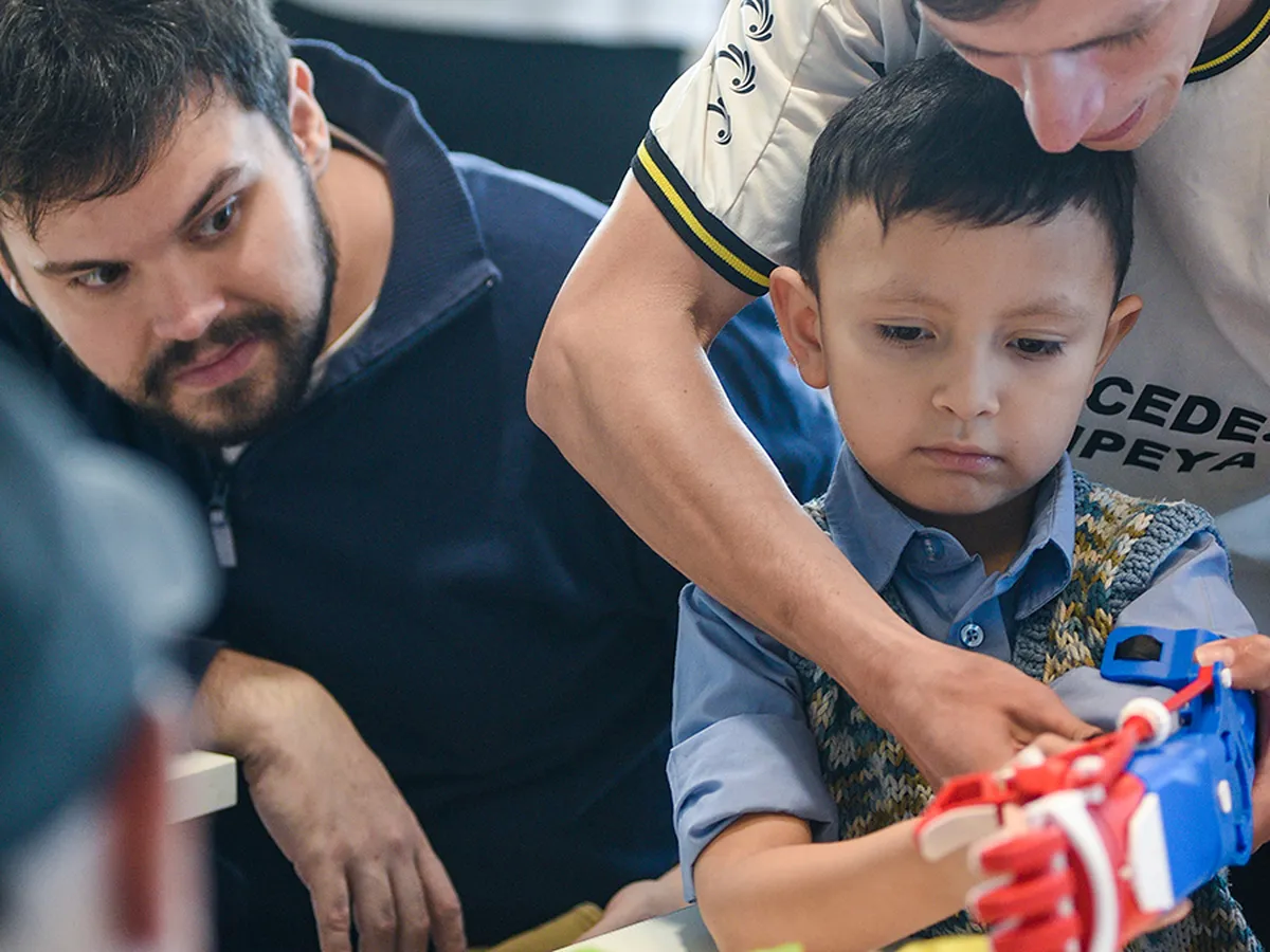 El Manotón es la gran ayuda que reciben padres e hijos cuando no pueden comprar un prótesis