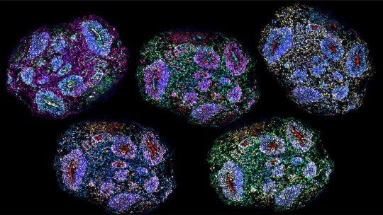 Ungrupo de científicos realizó un experimento en el que llevan en estado demaduración unos minicerebros humanos cultivados en laboratorio.