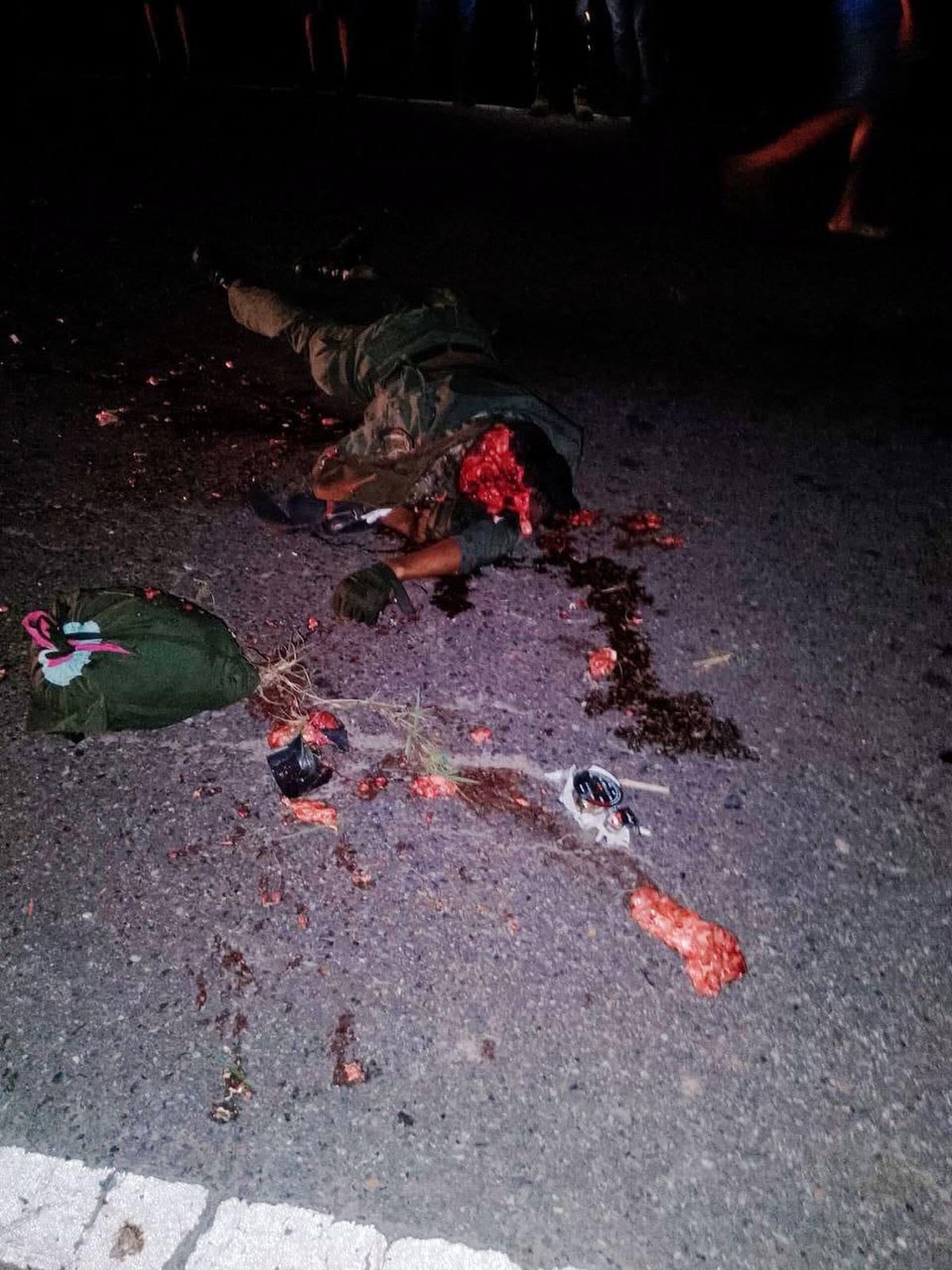 Bajas irreversibles en Fuerte Tiuna, Caracas (Venezuela). Bajas irreversibles en Fuerte Tiuna, Caracas (Venezuela).