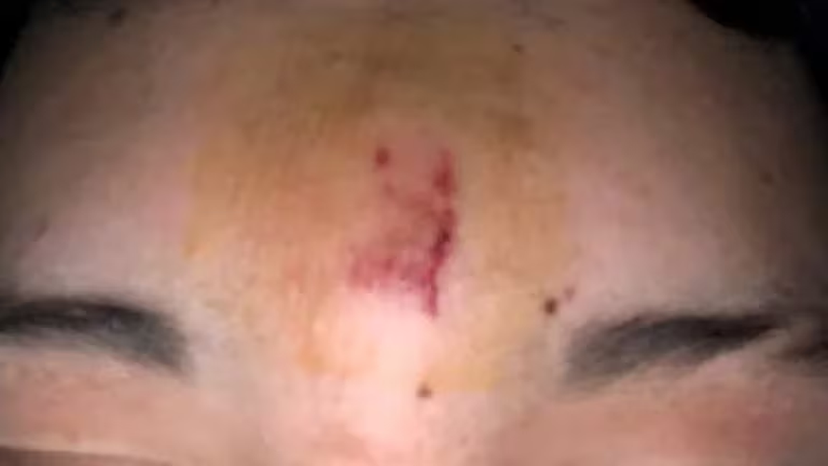 El alumno terminó con una contusión en la frente producto de la agresión física. El alumno terminó con una contusión en la frente producto de la agresión física.