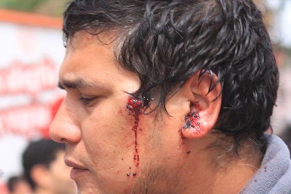 Uno de los camioneros heridos. (Foto: Radio3 Cadena Patagonia)
