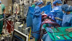 Vivir 48 horas sin pulmones: Cirujanos de Northwestern Medicine desarrollaron un sistema de pulmón artificial total para mantener vivo a un paciente durante 48 horas. / imagen: Northwestern Medicine