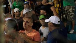Andrés Bracamonte.en una ocasión que le metieron 3 balas de goma en el rostro.
