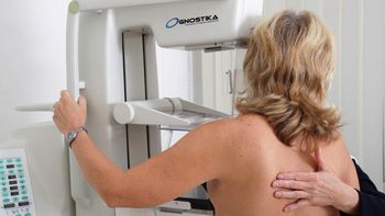 No sólo cáncer de mama: Impacto por lo que la IA es capaz de detectar en la mamografía