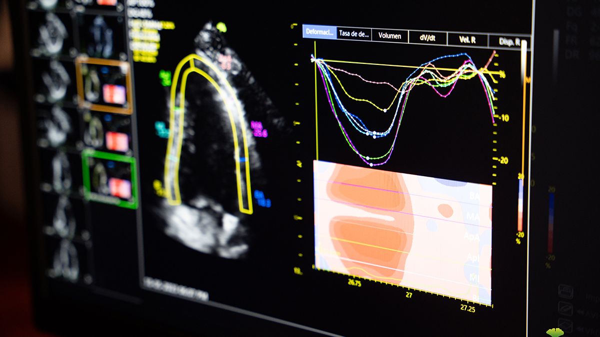 La empresa CSH (Centro de Servicios Hospitalarios) en Argentina continúa con su innovación en diagnóstico por imágenes con la tecnología en ultrasonido. La empresa CSH (Centro de Servicios Hospitalarios) en Argentina continúa con su innovación en diagnóstico por imágenes con la tecnología en ultrasonido.