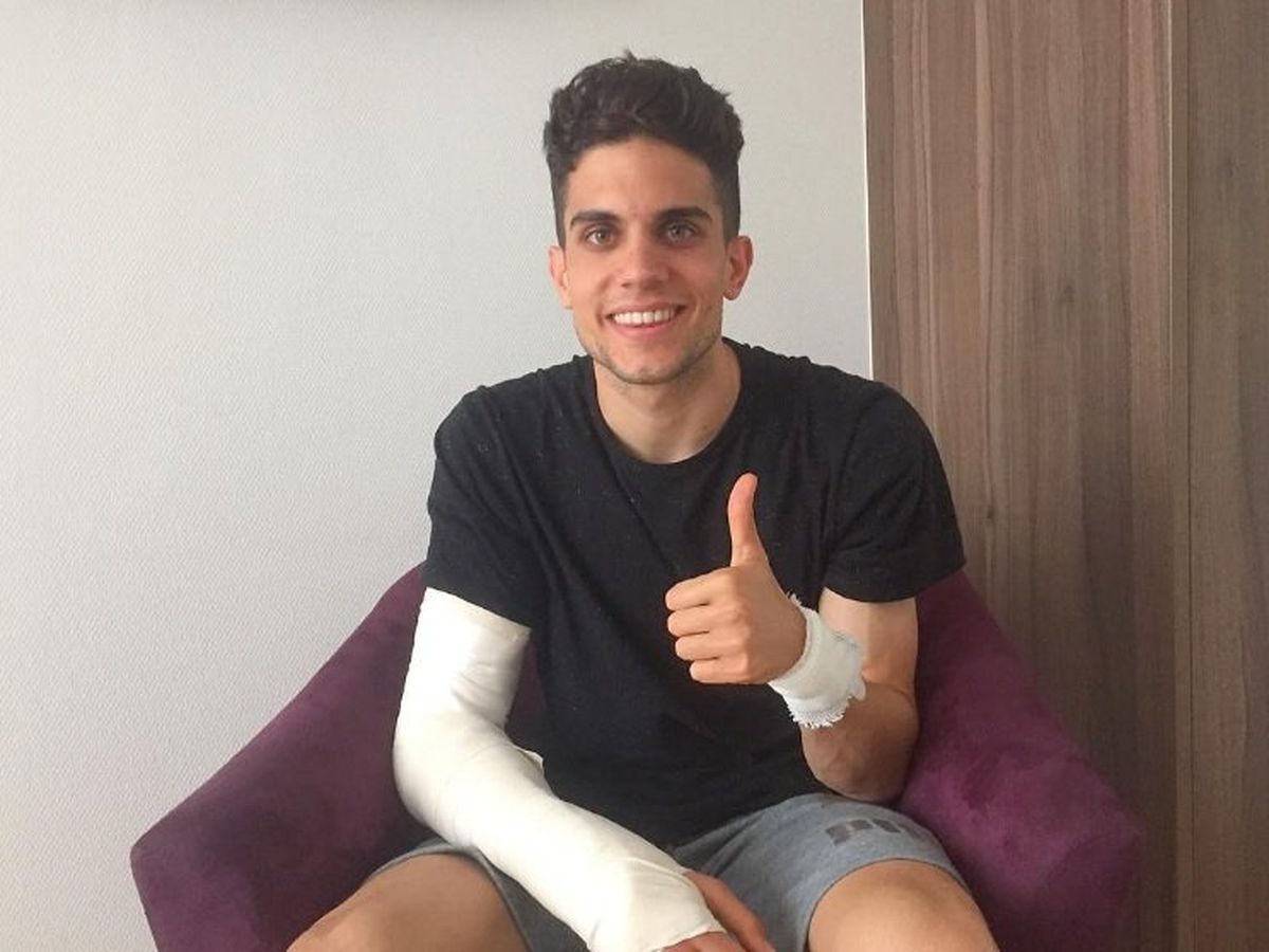 Marc Bartra tras la operación en la muñeca derecha por las heridas que sufrió en el atentado contra el autobús del Dortmund. Marc Bartra tras la operación en la muñeca derecha por las heridas que sufrió en el atentado contra el autobús del Dortmund.