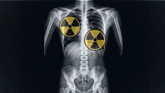 Pilotos y auxiliares de vuelo quedaron entre las ocupaciones con mayor proporción de muertes por cáncer asociado a radiación en el análisis.