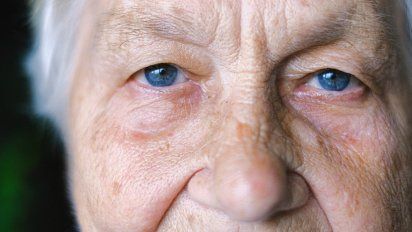 Alzheimer: Estos son los síntomas de advertencia en los ojos