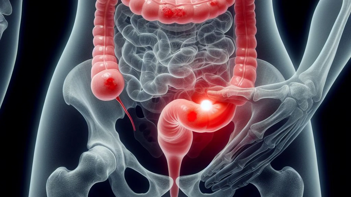 Argentina tiene una de las tasas de incidencia de cáncer más altas de Latinoamérica. El cáncer de pulmón y de colorrectal son de los más comunes tanto en hombres como en mujeres. Argentina tiene una de las tasas de incidencia de cáncer más altas de Latinoamérica. El cáncer de pulmón y de colorrectal son de los más comunes tanto en hombres como en mujeres.