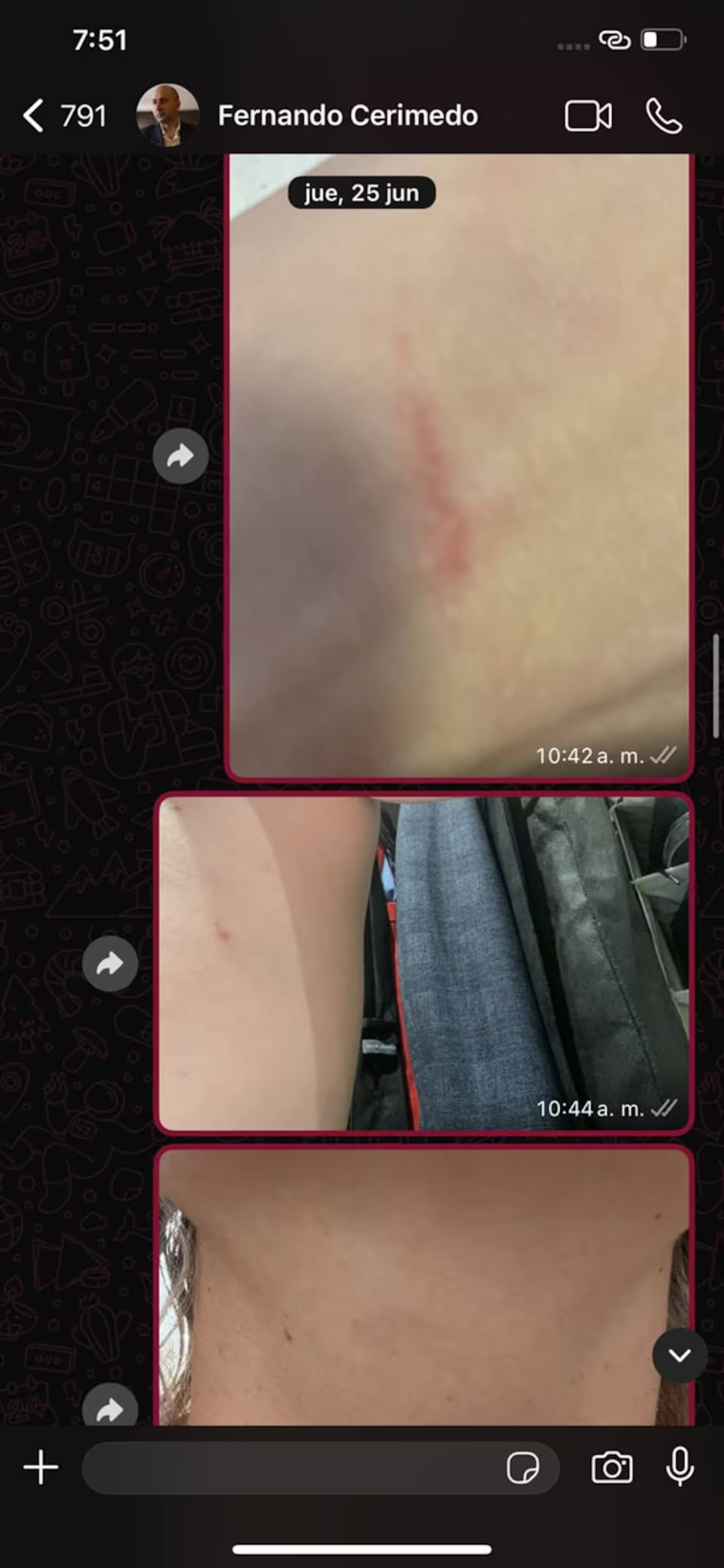 Beller difundió los chats donde denunció golpes, ahorcamiento y lesiones de parte de Cerimedo. Foto: X Beller difundió los chats donde denunció golpes, ahorcamiento y lesiones de parte de Cerimedo. Foto: X