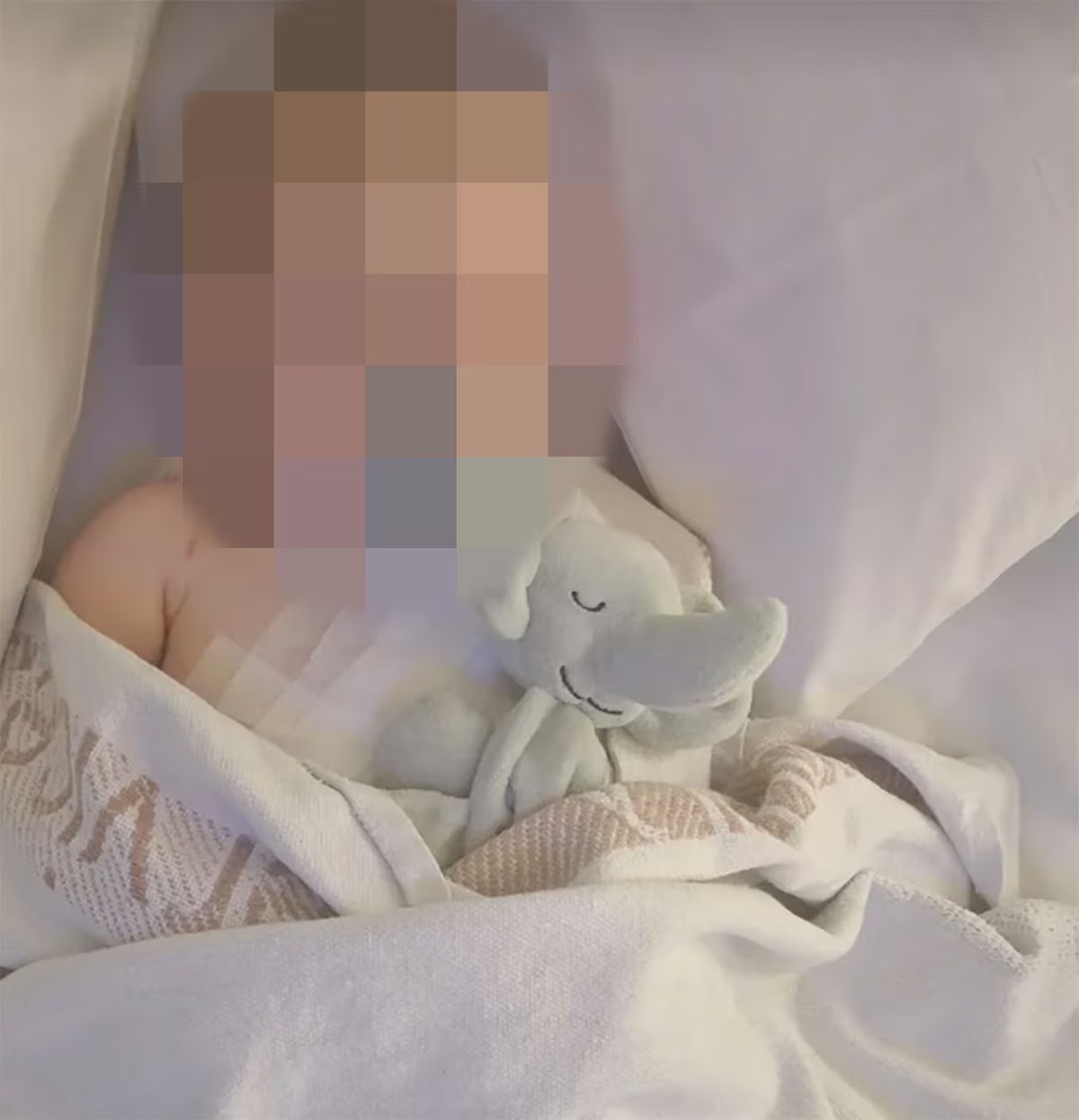 El bebe debió ser sometido a múltiples cirugías por las quemaduras. El bebe debió ser sometido a múltiples cirugías por las quemaduras.