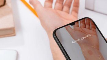 la nueva funcion de google lens: ahora detecta problemas en la piel la nueva funcion de google lens: ahora detecta problemas en la piel