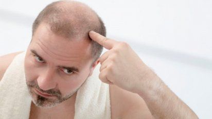 Alopecia: Hallan inesperada causa de la caída del pelo
