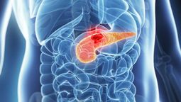 Cáncer de páncreas: Cuidado con esta bebida conocida.