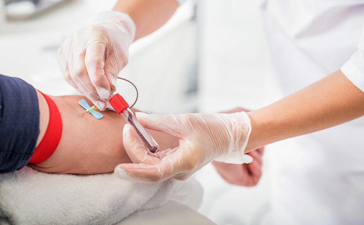 Los laboratorios de análisis de sangre y orina el adulto mayor debe hacerlos con frecuencia anual si su estado de salud es normal y más frecuentes para el seguimiento de patologías.&nbsp;