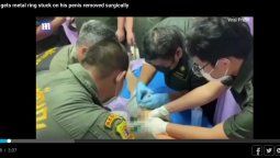 altText(Otro más: Pene de tailandés atrapado en un anillo de acero)}
