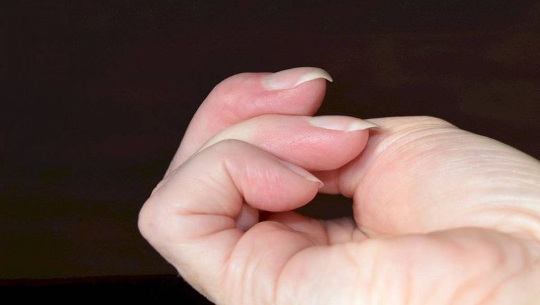 7 señales extrañas de que puede tener enfermedad cardíaca