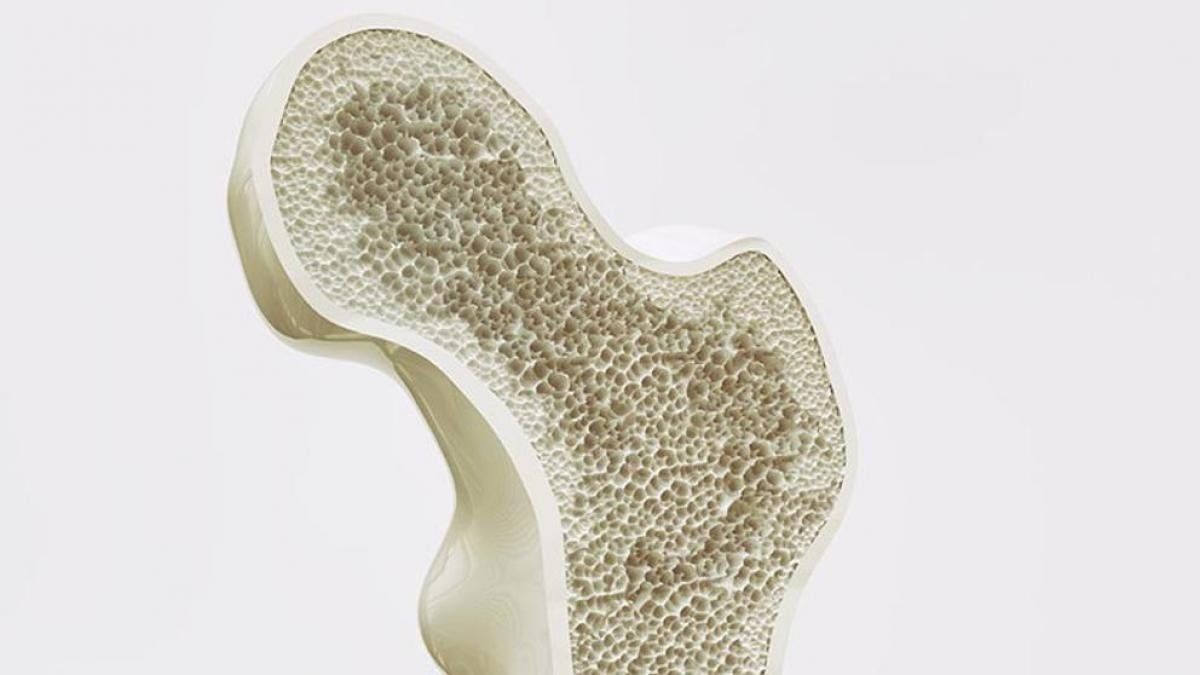 Este alimento te hace más propenso a osteoporosis, según expertos.
